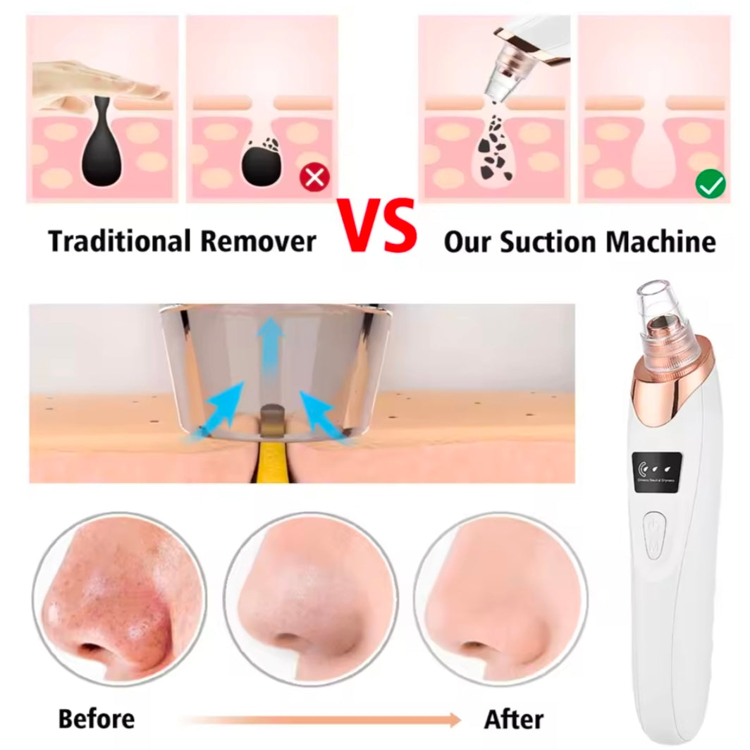Blackhead Remover Nose T Zone Pore Vacuum Acne Pimple Removal Vacuum Suction Tool Facial Diamond Dermabrasion Machine Face Clean